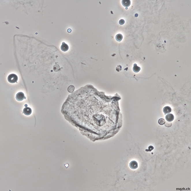 MQ 2012-3 Urinsediment U4