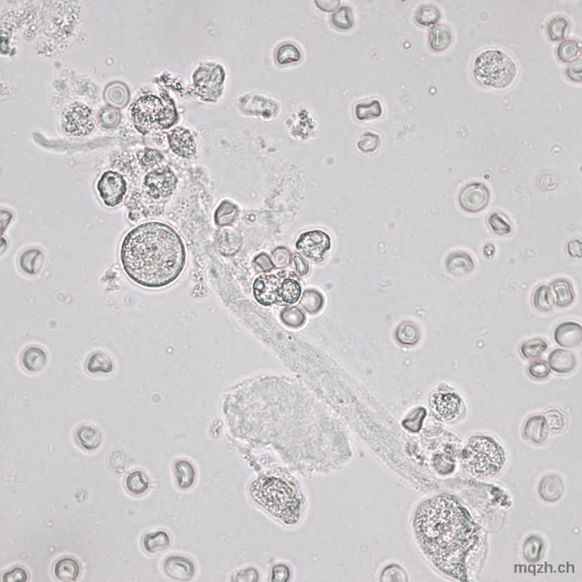 MQ 2013-1 Urinsediment U4