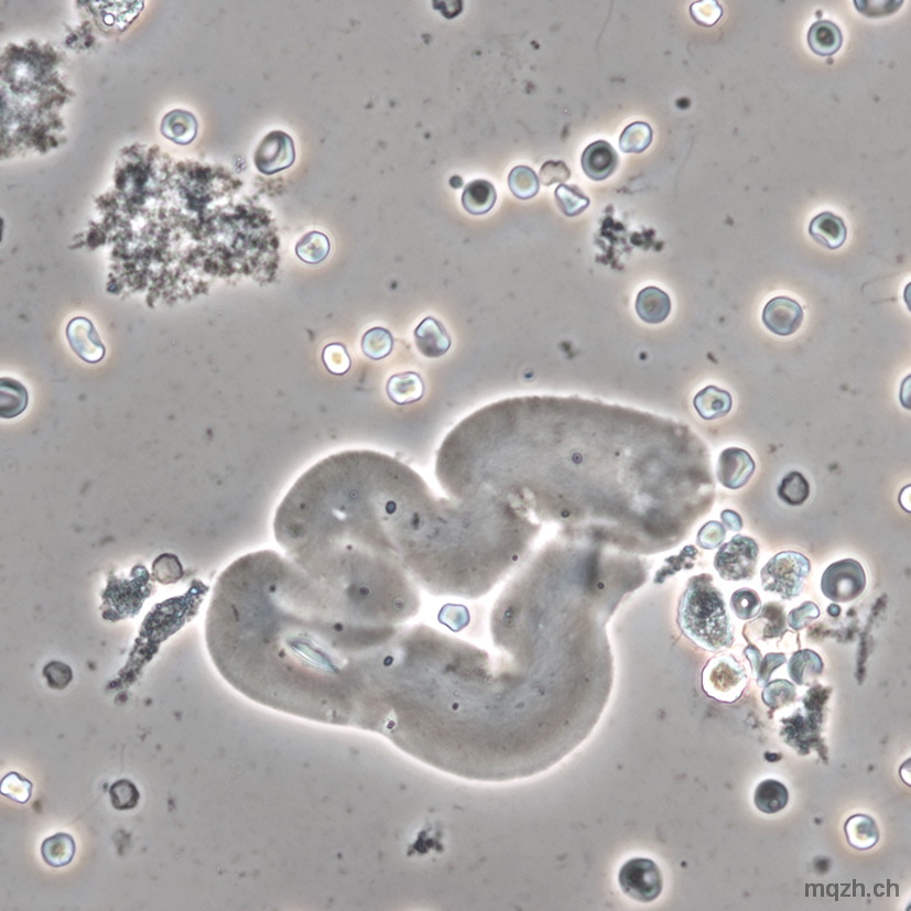 MQ 2013-1 Urinsediment U4
