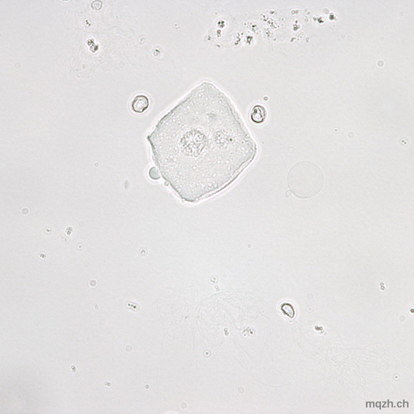 MQ 2013-3 Urinsediment U4