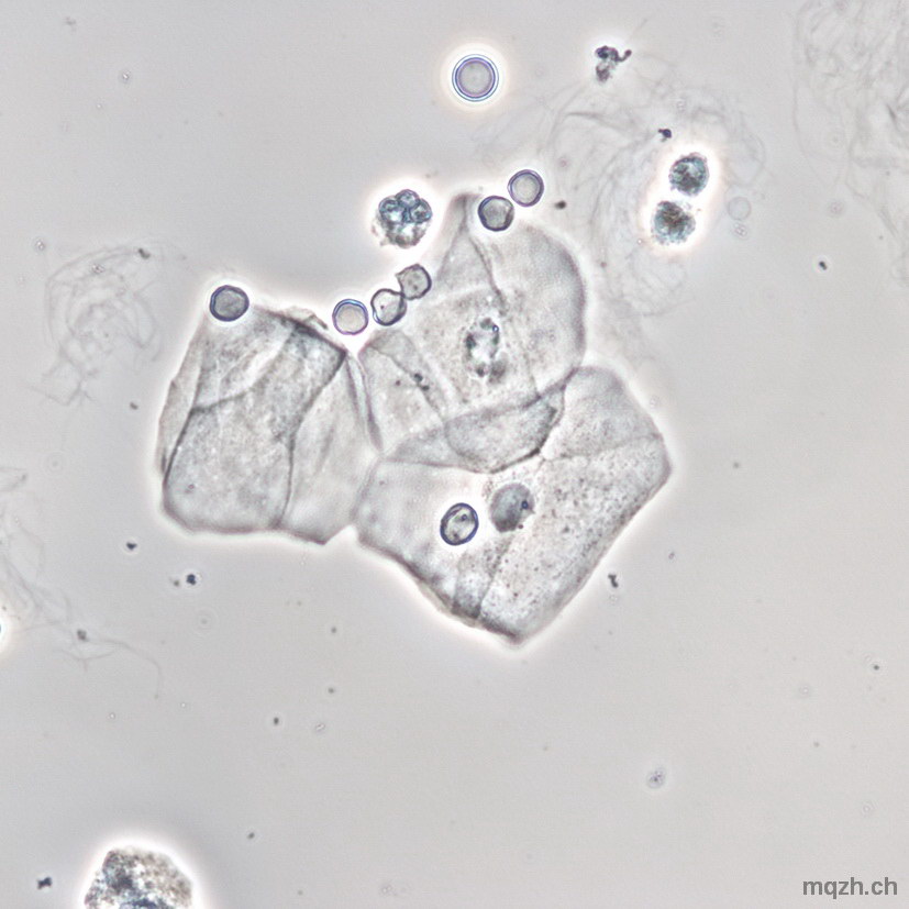 MQ 2013-3 Urinsediment U4