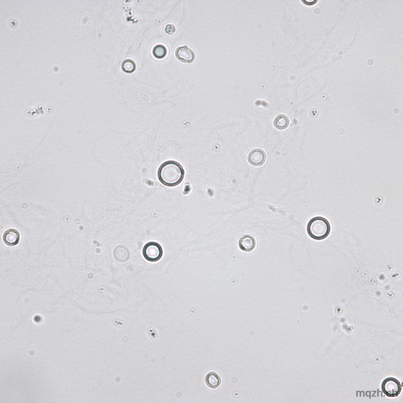 MQ 2013-3 Urinsediment U4