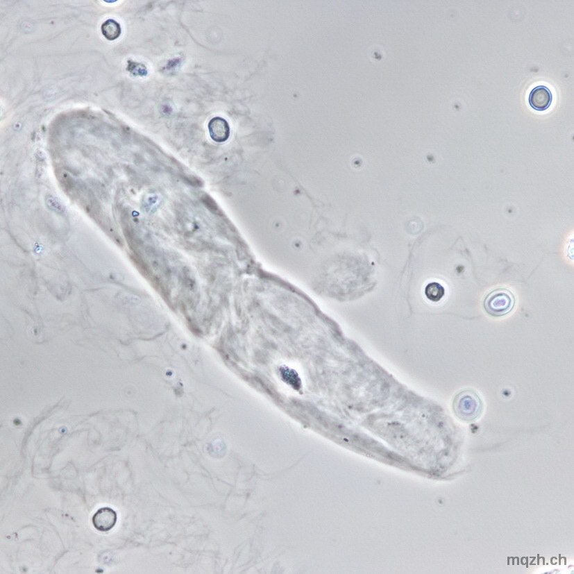MQ 2013-3 Urinsediment U4