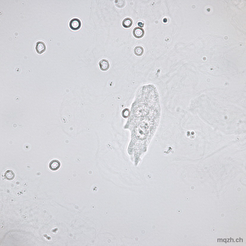MQ 2013-3 Urinsediment U4