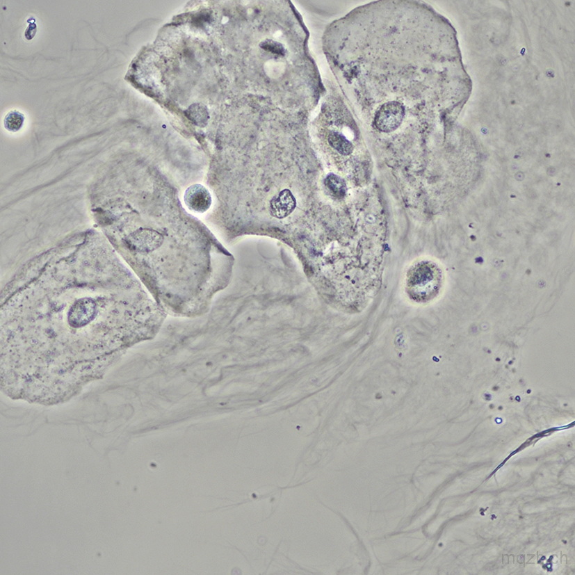 16p
