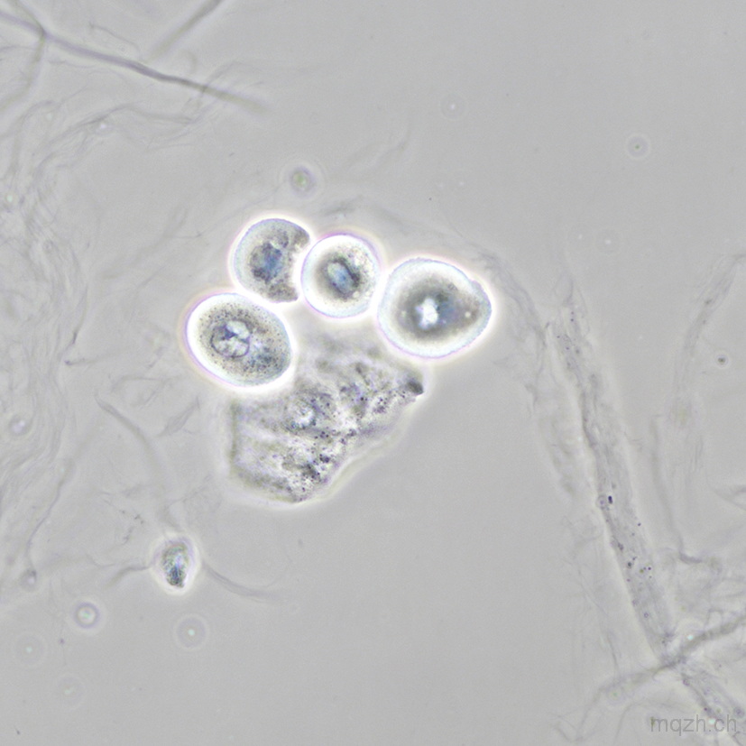 14p