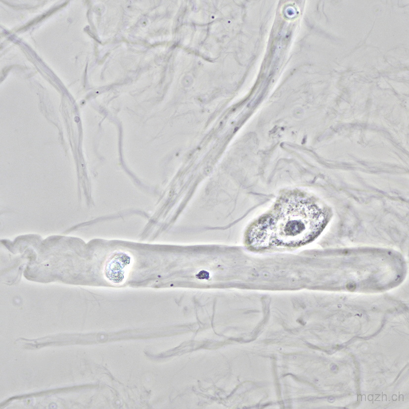 16p